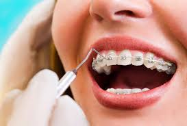Experience Accelerated Orthodontics in Winnipeg Designed for Active Adults on the Go